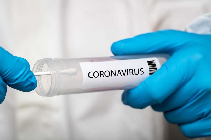 Read more about the article Pozor, ti nepreverjeni testi na novi koronavirus lahko pokažejo lažno pozitivno reakcijo