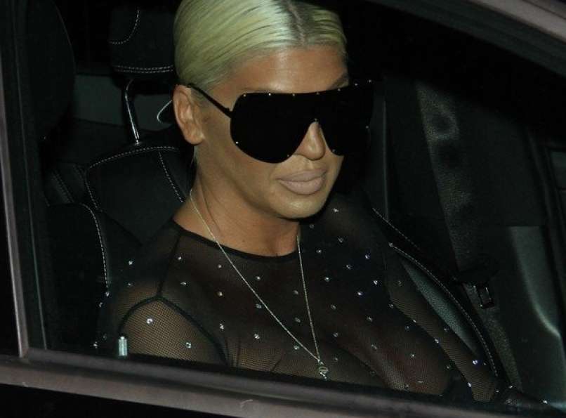 Read more about the article Karleuša razkrila, kaj vse na njej je umetno