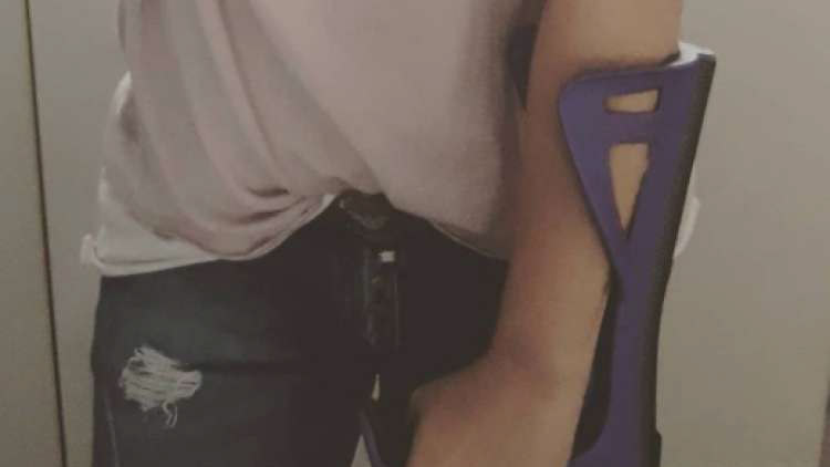 Read more about the article Anja Rupel uspešno prestala operacijo