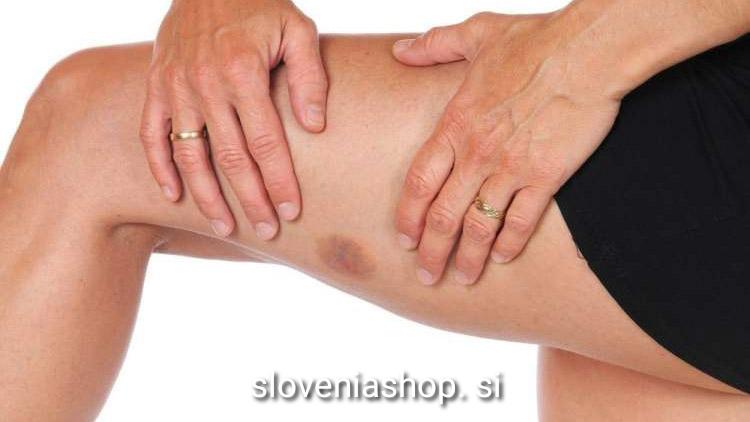 Read more about the article Od kod nenadoma spet temna zaplata na koži ?